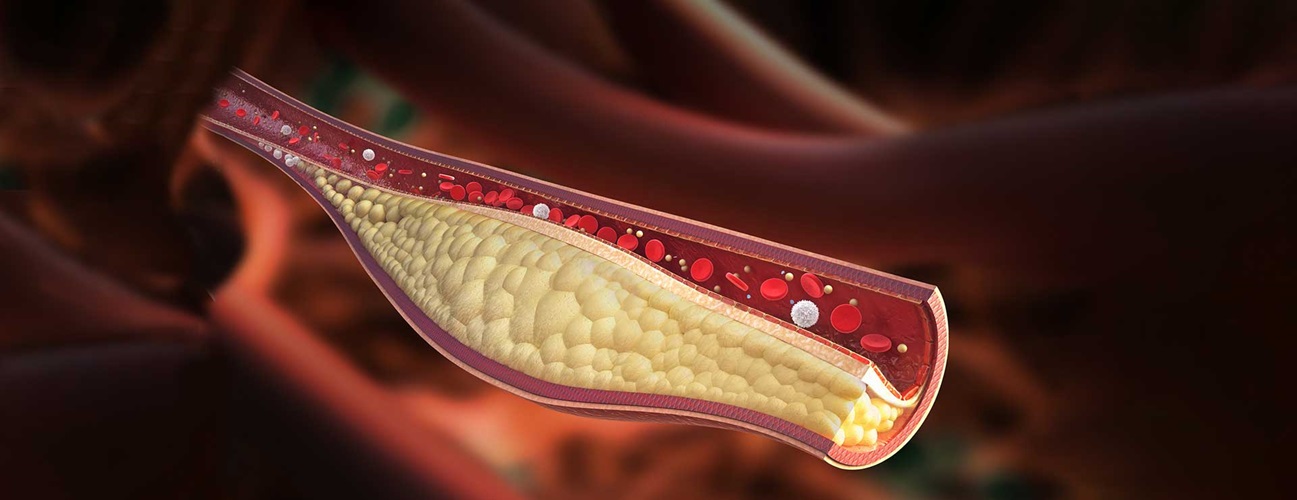 Truth About Cholesterol